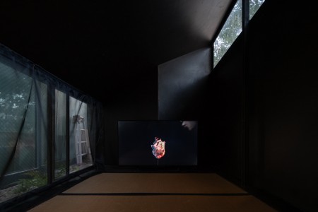 146 NAK02658　ToLoLo